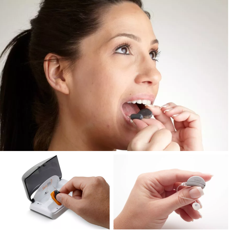 世界初認証の歯骨伝導型補聴器「SoundBite」、難聴者の力に | 36Kr