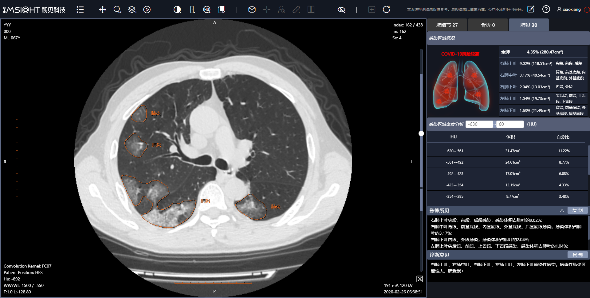 10秒讀一張CT，2年內(nèi)成熟病種的AI輔診會普遍應(yīng)用 | 超級觀點(diǎn)