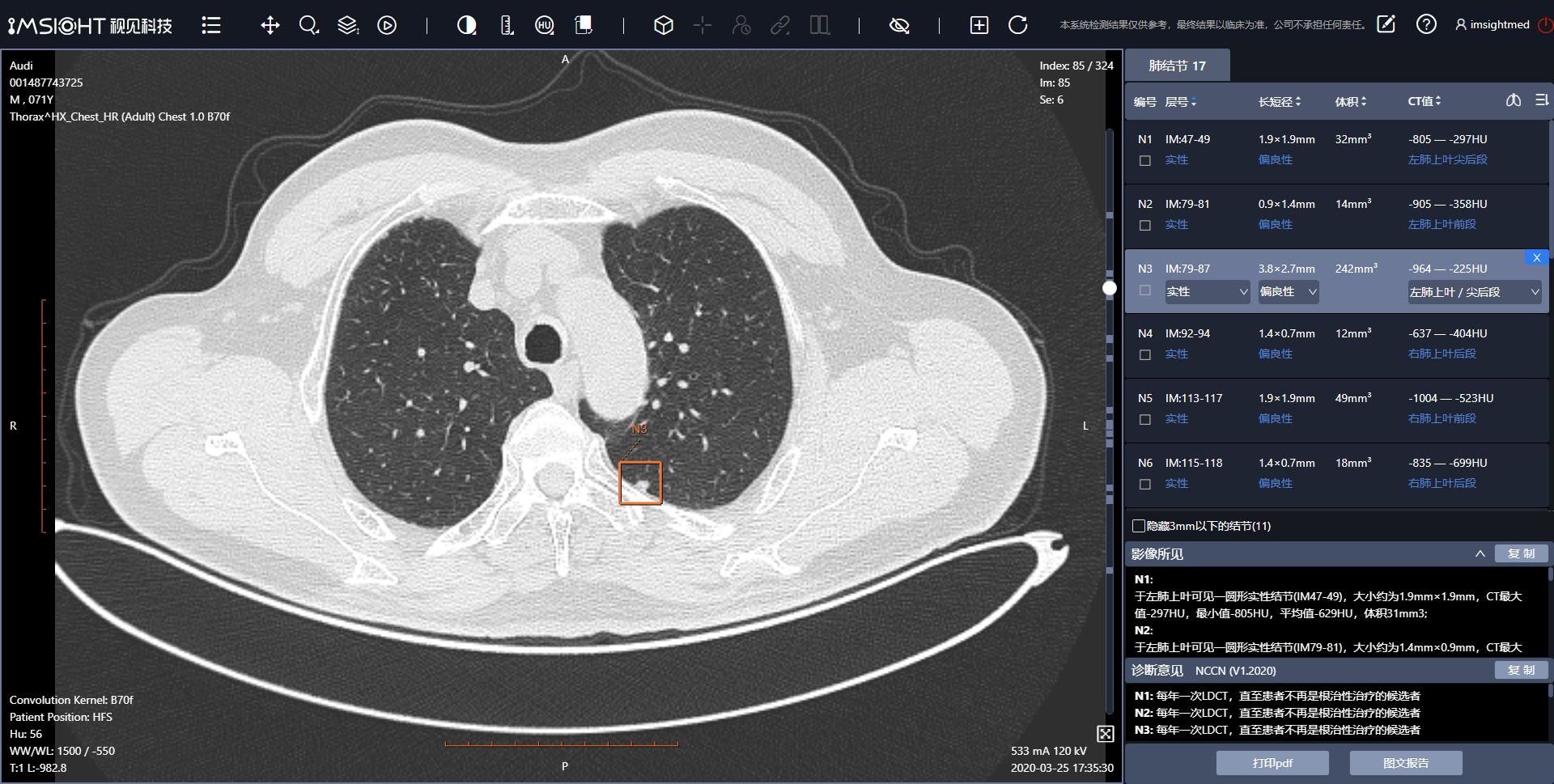 10秒讀一張CT，2年內(nèi)成熟病種的AI輔診會普遍應(yīng)用 | 超級觀點(diǎn)