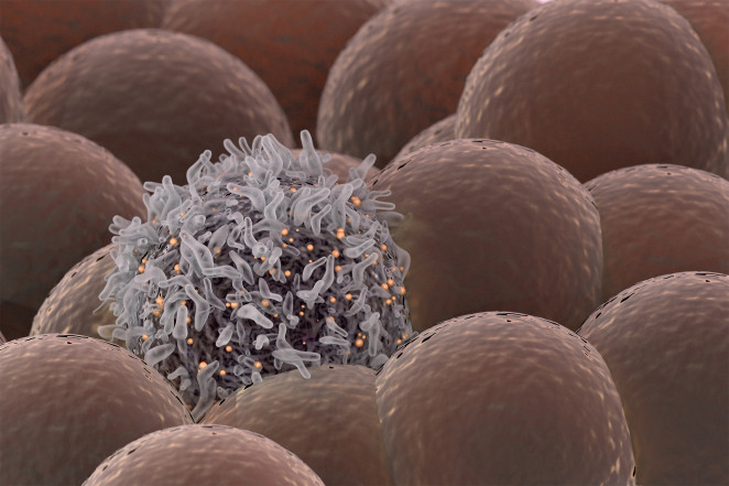癌症治疗新进展：能够钻孔的纳米机器，每分钟杀死一个癌细胞