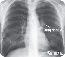 AI医疗来袭，患者、机构、数据科学家分别有哪些新机会？