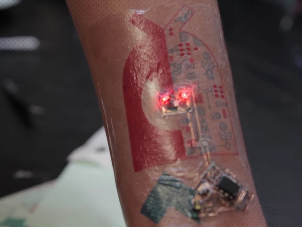 未来能杀死 iWatch 们的电子纹身“来袭 ”| 图说