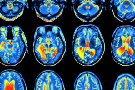 AI 是友非敌？自杀预防技术已成功挽救 25 人生命