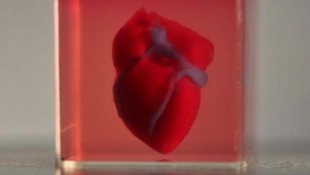 全球第一个 3D 打印的「人造心脏」诞生了