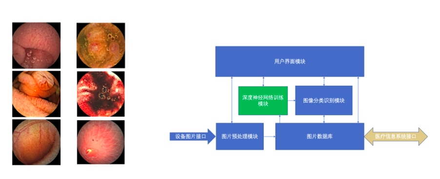 专注于消化道方向，MediRadar致力于将深度学习应用于医疗影像自动化诊断   