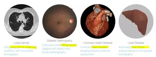 腾讯砸1亿投下这家AI医疗公司，但这个新风口开启前的医疗创业寒冬你是否还记得？