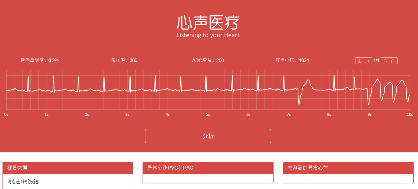 当AI遇上心电图，「心声医疗」帮医生自动生成诊断报告