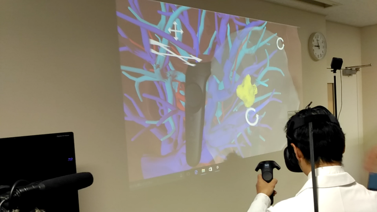 VR 器官模型进入日本医院，做手术就像玩赛车游戏