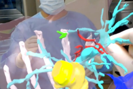 VR 器官模型进入日本医院，做手术就像玩赛车游戏