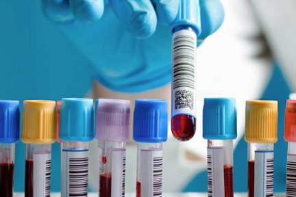 定位于预防性健康服务平台，「检康」要让采血送检变得“触手可及”