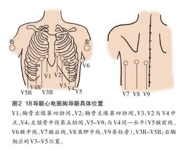 自主研发18导全信息动态心电分析系统，「蓬阳医疗」获数千万元A轮融资 　　