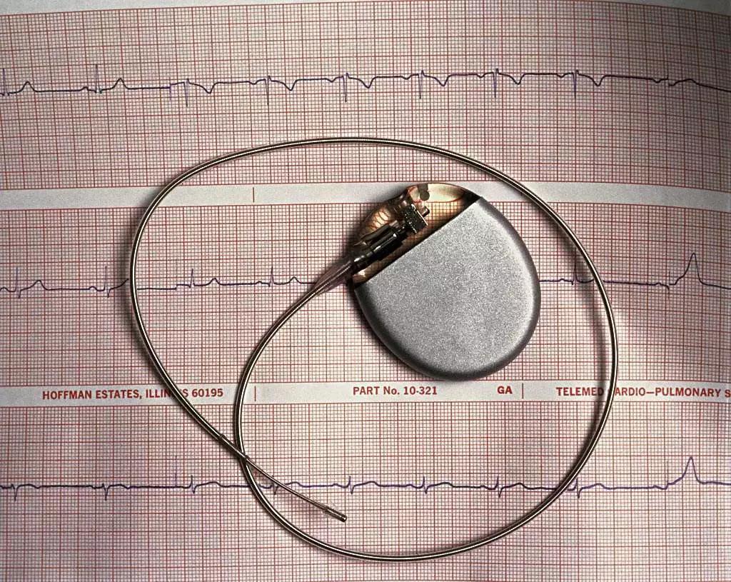 植入设备越来越多，“体联网”或许正在形成
