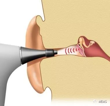 潮科技 | 新型MEMS超声换能器问世，或可用于中耳感染快速诊断