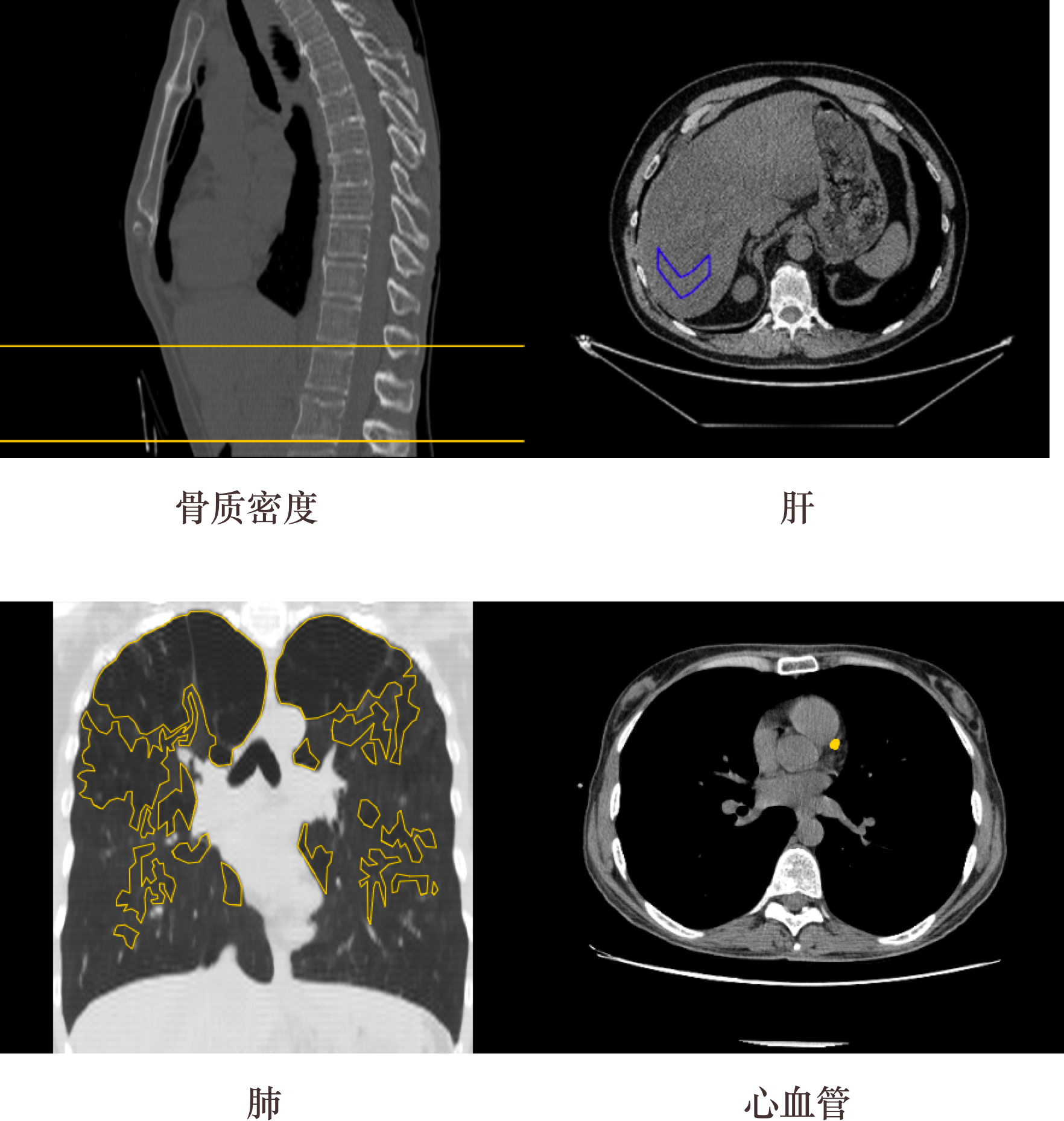 2019上半年数字医疗成果：软体机器人、诊断早期恶性肿瘤等