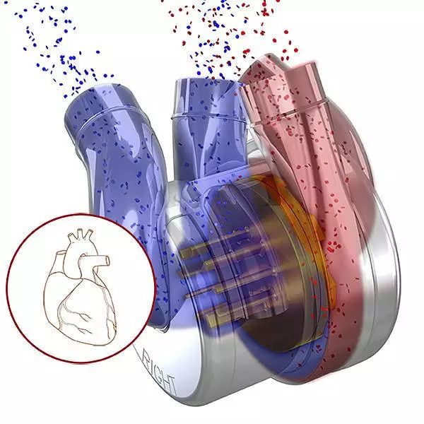 德州心脏研究所研制出磁悬浮心脏，每秒2000转，为心衰患者续命