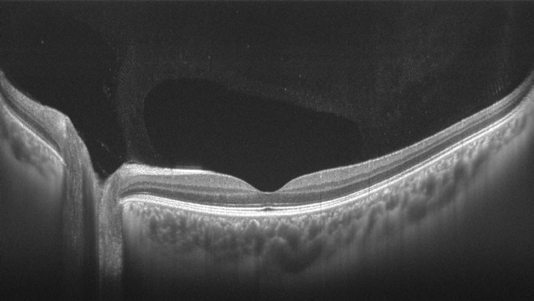 融资合伙人入围项目眼科扫频oct产品进口替代进行时图湃影像认为一