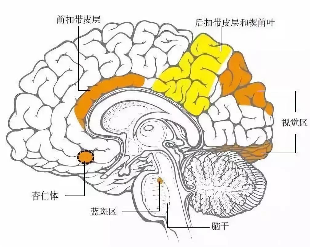 在2007年的另一项研究中,研究人员试图通过扫描两组患者的大脑来区分