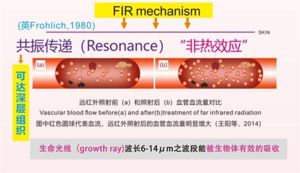 石墨烯迎来最新产业应用？「烯旺科技」在医疗领域做出突破