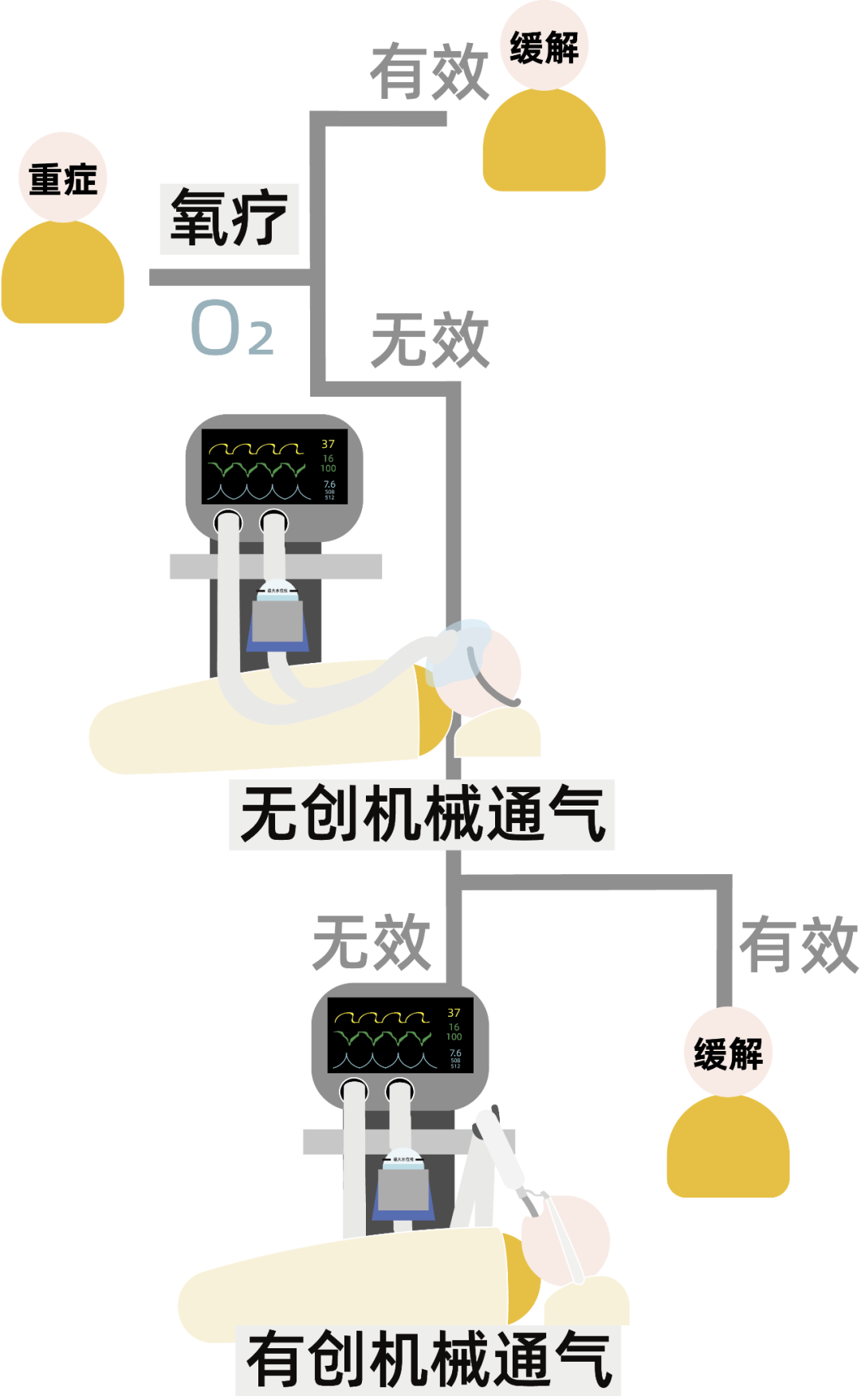 关于呼吸机你该知道的9个问题