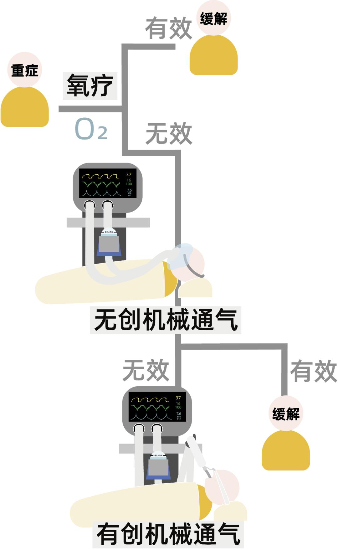 关于呼吸机，你该知道的9个问题