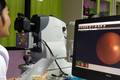 谷歌AI“翻车”泰国：眼疾检测实验室准确率达90%，但是小诊所传张照片就得等两小时