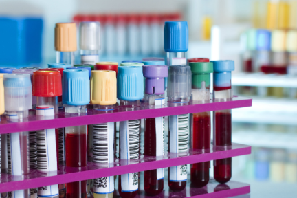 分析国内50多家液体活检企业，抢占早筛早诊市场和成本管控是关键