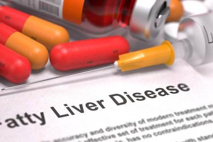 焦点分析 | OCA上市申请被拒，NASH创新药走向大众化“凉凉”？