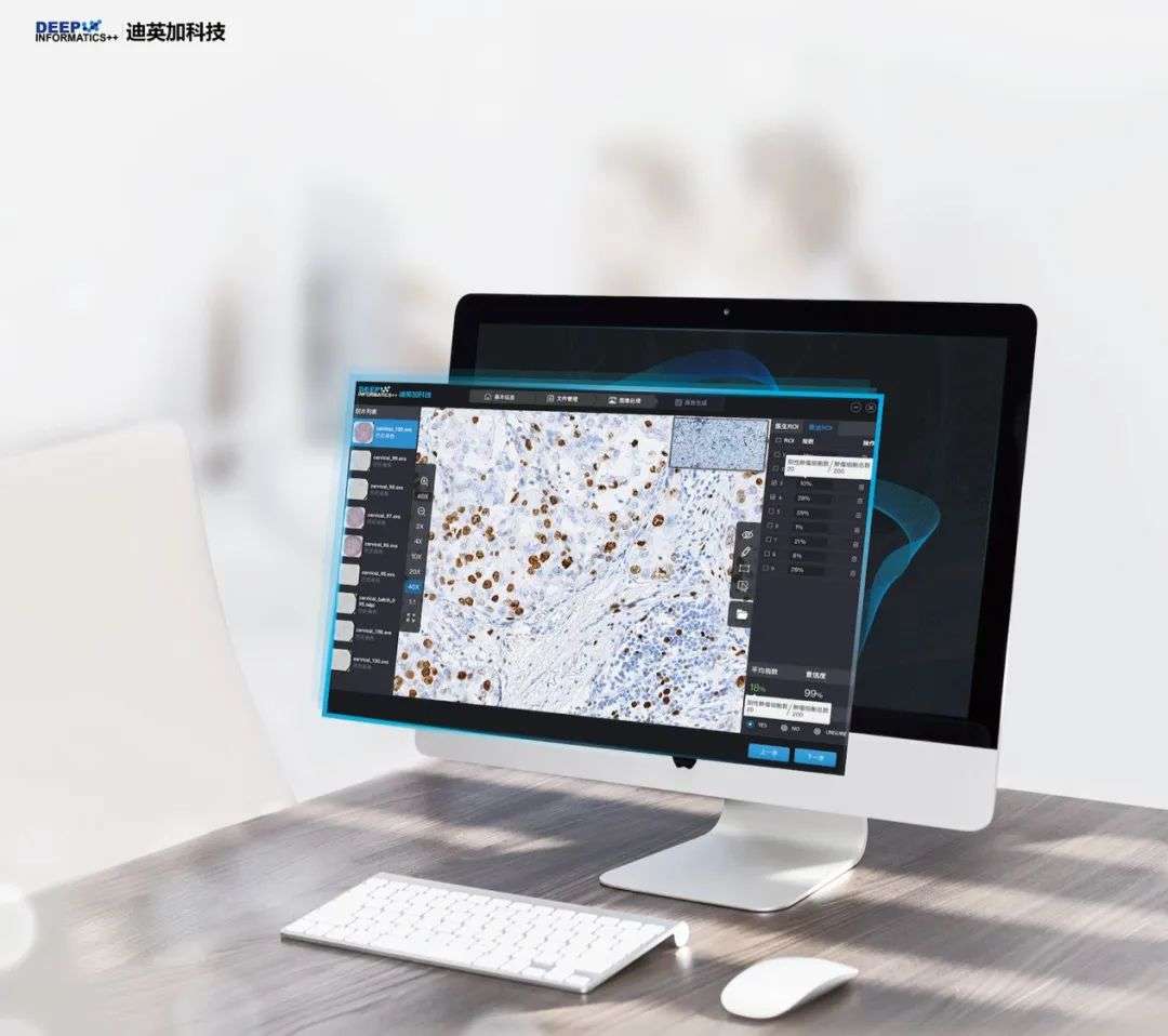 AI+病理诊断 迪英加辅助病理诊断