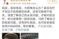 祛痘、植发、整牙：微博的辣眼广告为何既不精准，又不智能？