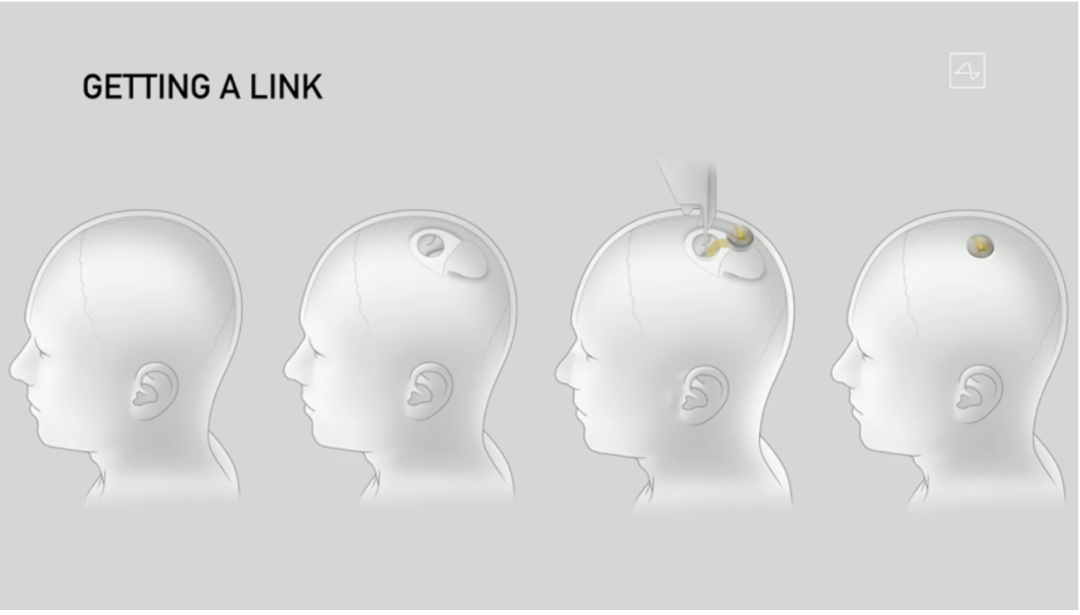 开头颅插芯片？让马斯克疯狂的脑机接口究竟是什么？