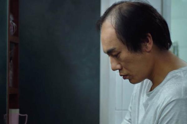 中国脱发地图出炉，这里的人最秃