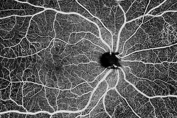 专注高端眼科影像设备，「视微影像」完成超亿元B轮融资