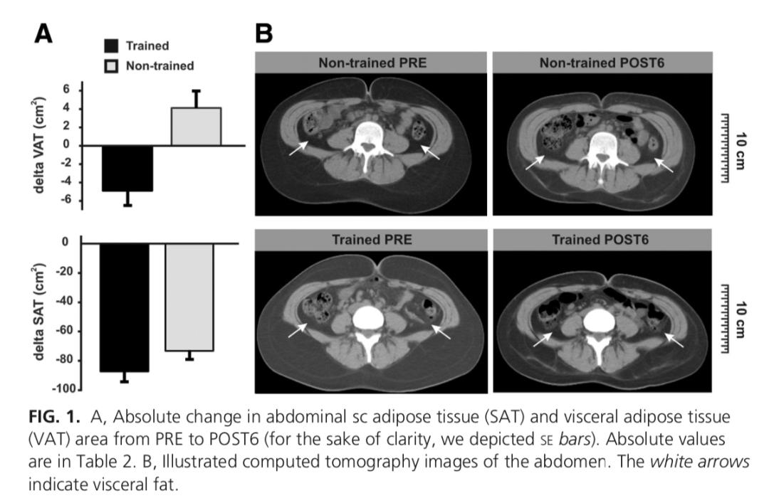 减肥手术有什么危害_减肥手术后遗症_手术减肥