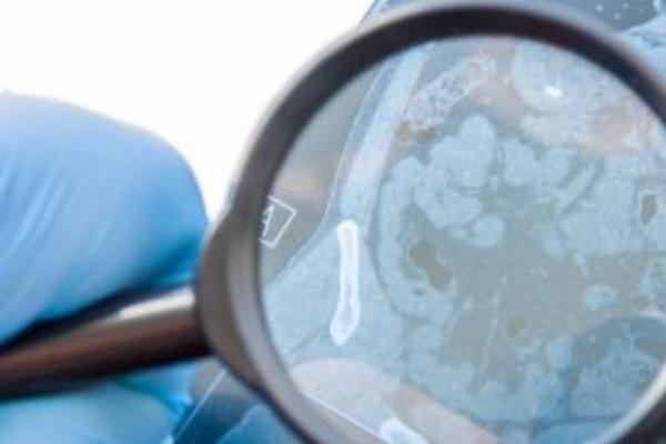 合作开展全周期疾病管理，「琅钰集团」加速布局中国罕见病诊疗赛道