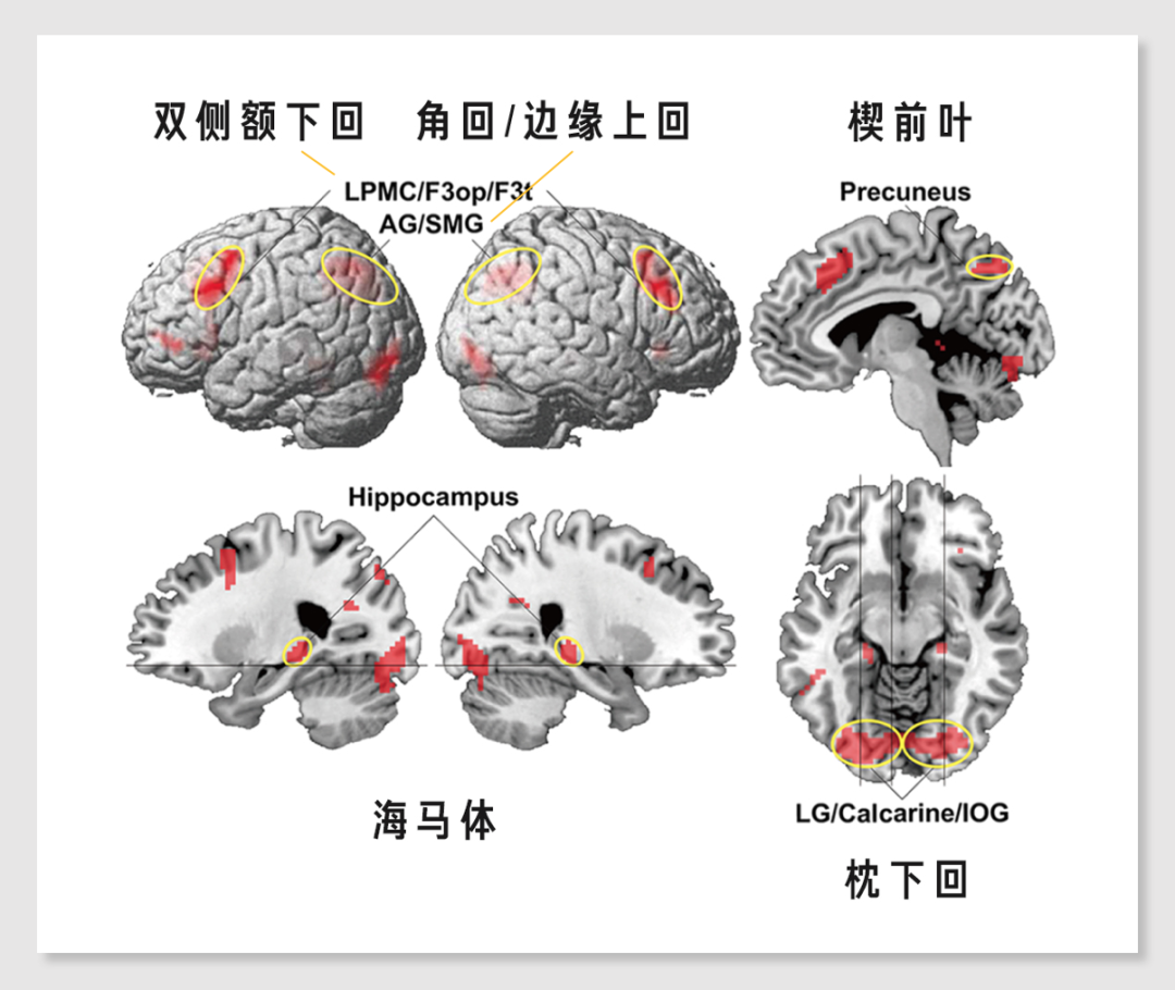 电脑诞生这么久，为什么你还是喜欢在纸上做笔记