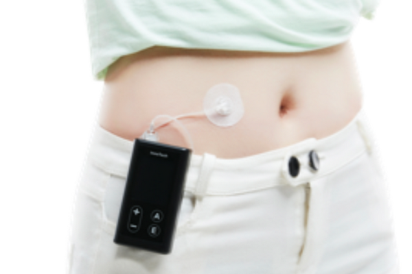 帮助糖尿病人微量输注胰岛素，「凯联医疗」完成逾亿元人民币C轮融资