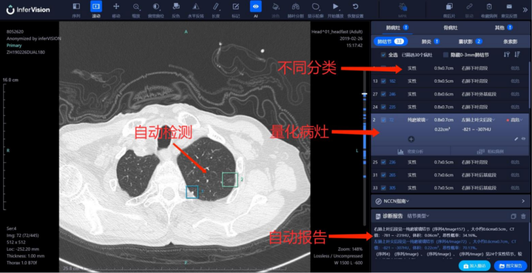 医疗AI的“千里眼”和“顺风耳”