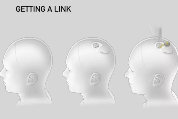 36氪周末副刊vol.7｜没想到，诞生了“人机结合”成就的奥运冠军