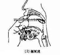 张杰被鱼刺卡住食道后，他做了一件最正确的事