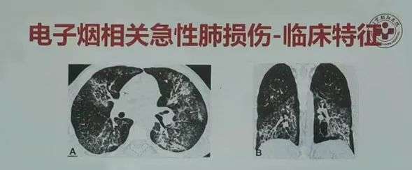 你抽的电子烟，让这个湖南老板身家640亿_详细解读_最新资讯_热点事件