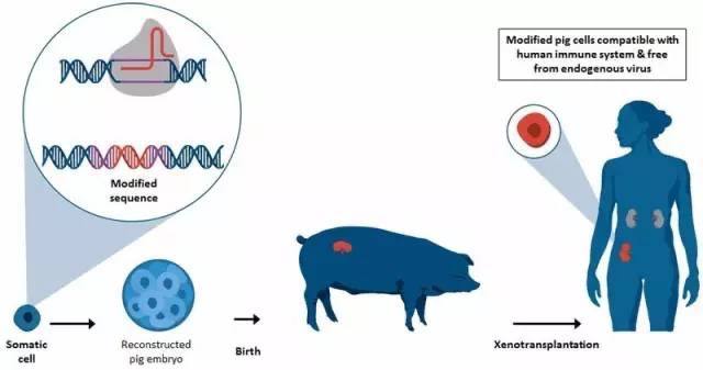 知料 | 猪肾成功植入人体，但器官移植新时代还远未到来