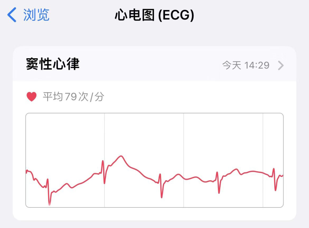 根据苹果官方介绍,ecg又称心电图,可以记录心脏的电生理运动,即构成