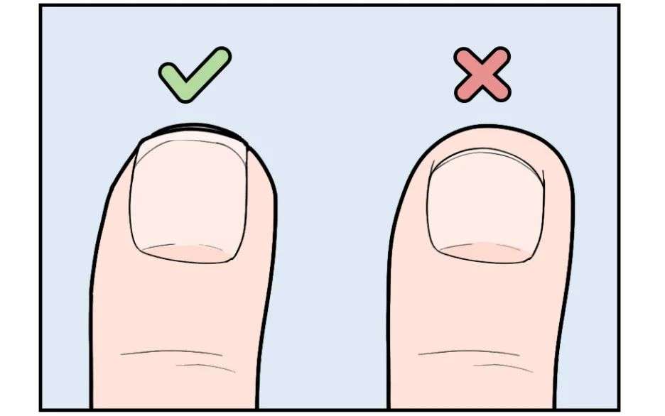 剪指甲的一个错误习惯让很多人痛苦不堪