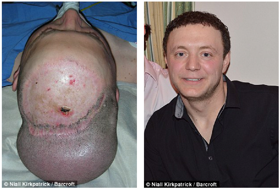 全身多处可应用