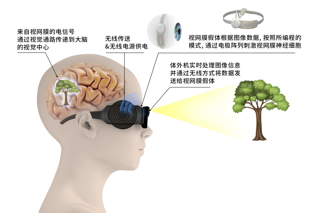 多款生物芯片加速落地，「暖芯迦」如何实现碳基生命与硅基电子的无缝融合？