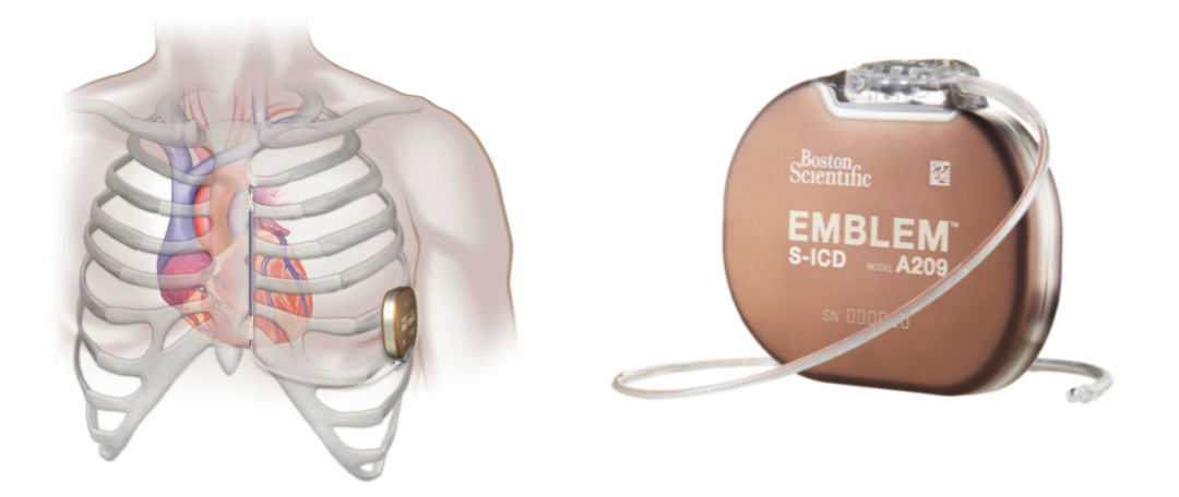 心脏性猝死可预防，专家呼吁高危人群植入“保命装置”(图2)