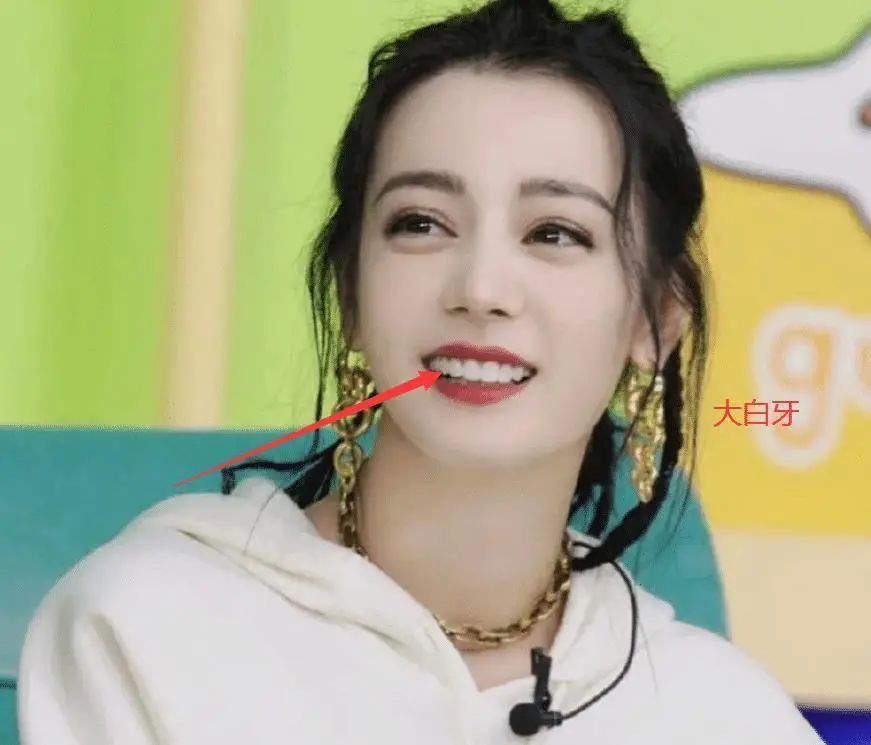 内娱标配烤瓷牙究竟毁了多少甜妹