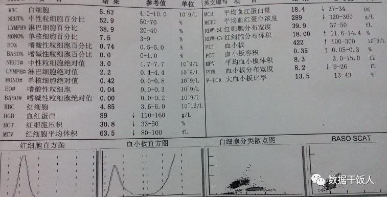 interlace,1