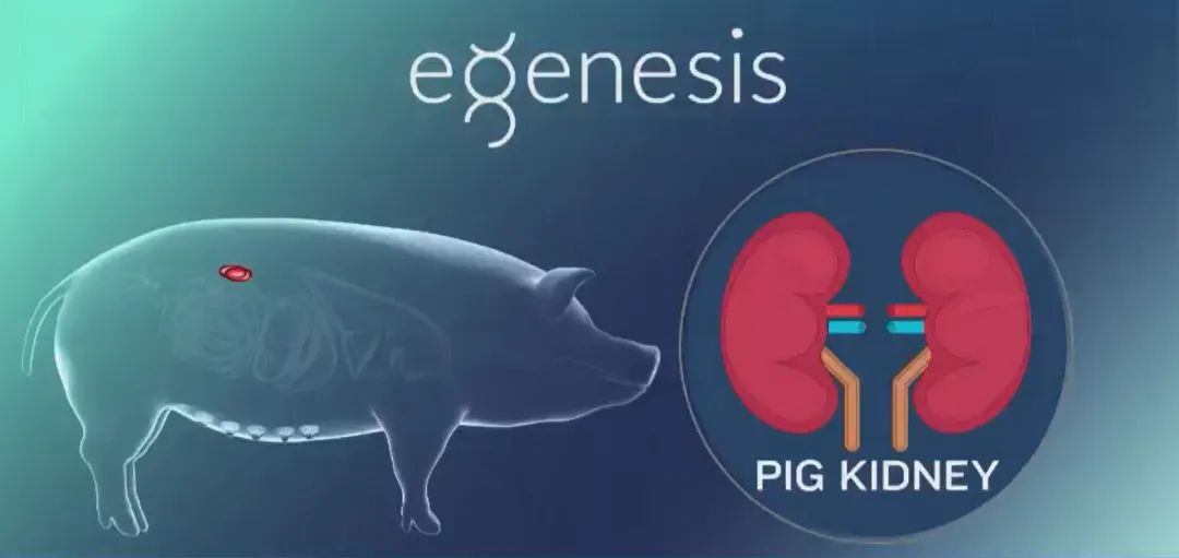 全球首例等不到人类肾脏的他移植了猪的