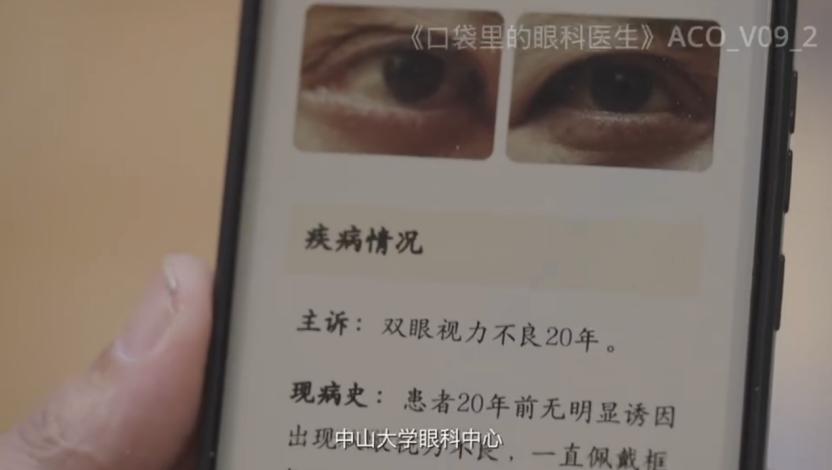 大规模筛查一周「看病」三千人，AI眼科大模型讲出了新故事